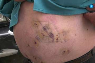 Antonio Torres explica como fue el atraco que sufrió el pasado viernes en Telde/Fotograma de RTVC.